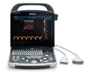 Система ультразвукова діагностична Mindray DP-30 з 2-ма датчиками, конвексним та лінійним