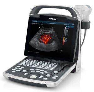 Система ультразвукова діагностична Mindray DP-30 з 3-ма датчиками, конвексним, лінійним та ендокавiтальним
