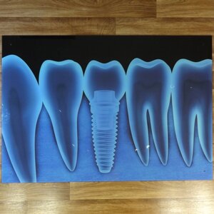 Постер / Скляна картина для стоматологічного кабінету Зуб