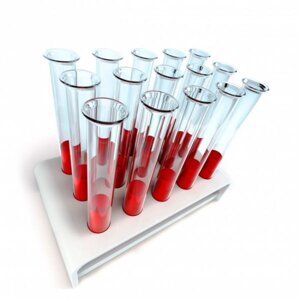 Системи для крапельниць та забору крові в Житомирі