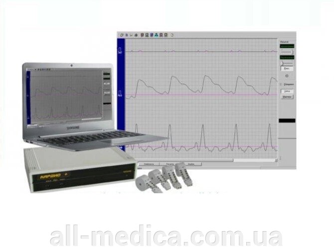 Діагностичний автоматизований комплекс "КАРДІО + реографом" від компанії Інтернет-магазин "ALL Medica" - фото 1