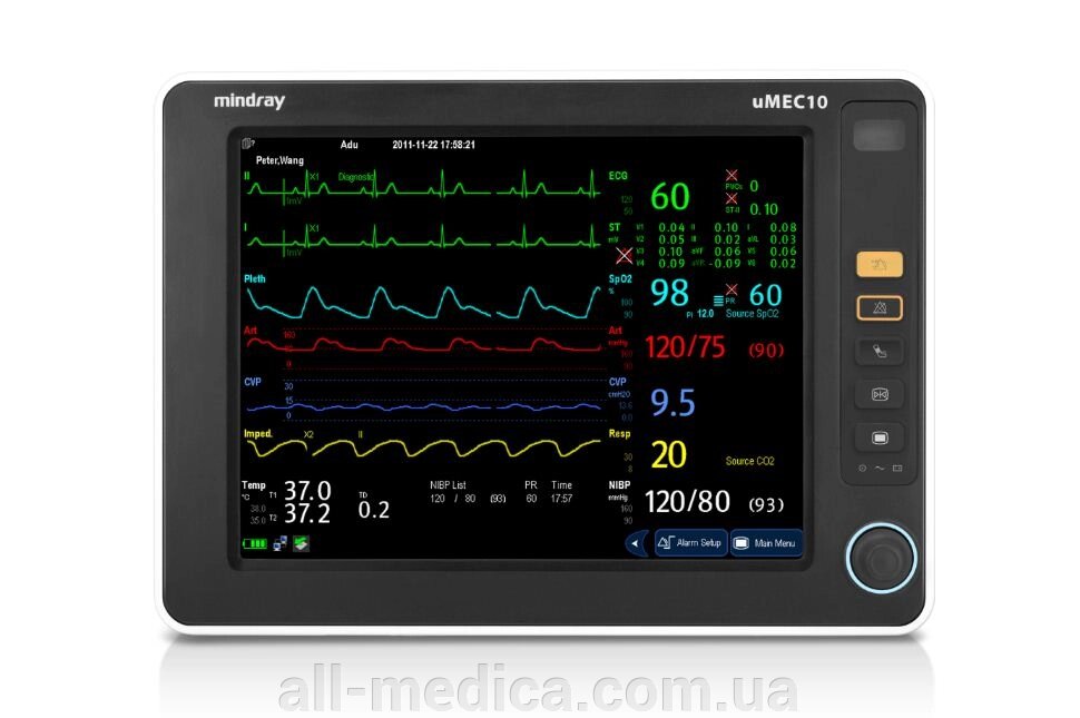 Монітор пацієнта uMEC10 ECG, SpO2, NIBP, Temp (база) від компанії Інтернет-магазин "ALL Medica" - фото 1