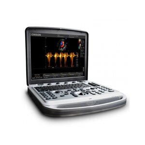 ЗІ апарат CHISON SonoBook 8 — 4 датчики