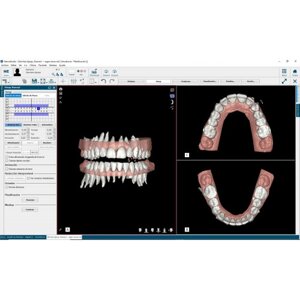 Цифровая стоматология NemoCast
