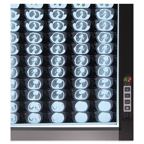 Світлодіодний медичний негатоскоп WL-1D від компанії Medzenet - фото 1