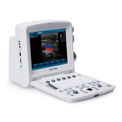 Ультразвукова діагностична система U50 Prime Edition Праймед від компанії Medzenet - фото 1