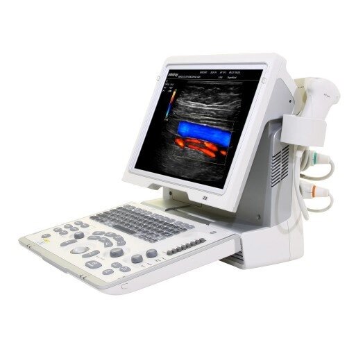 УЗД апарат Z5-ультразвукова діагностична система з кольоровим допплером від компанії Medzenet - фото 1