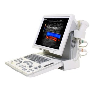 УЗД апарат Z5-ультразвукова діагностична система з кольоровим допплером