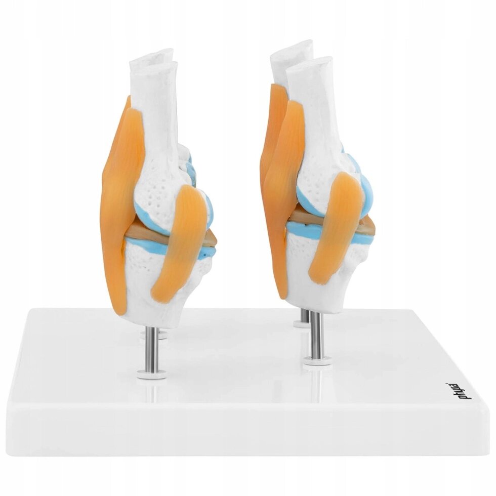 Анатомічна модель 3D Модель колінного ставу 4 Зміни захворювання 1: 2 від компанії Euromarka - фото 1