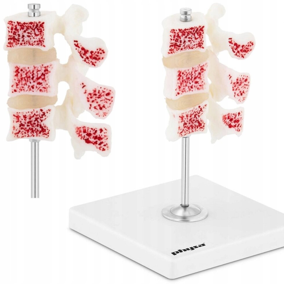 Анатомічна модель 3D остеопороз поперекових кіл від компанії Euromarka - фото 1