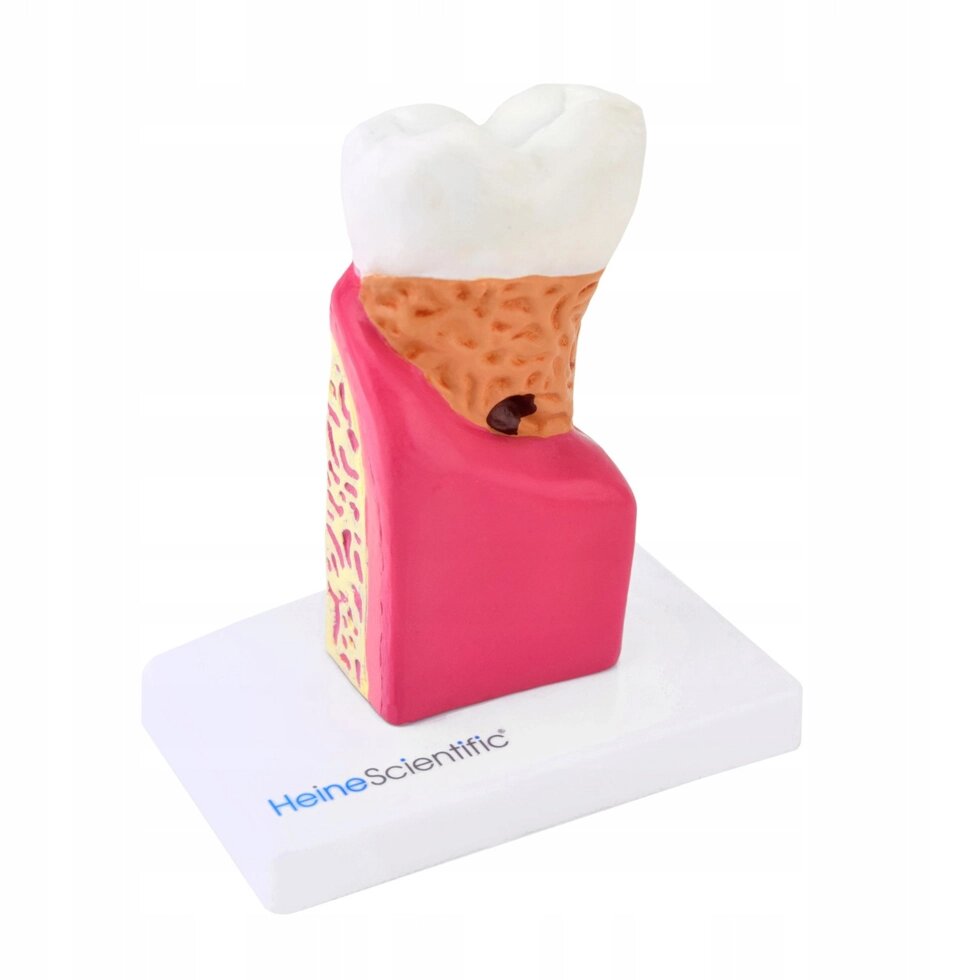 Анатомічна модель Молярна стоматологічна модель з різними патологіями від компанії Euromarka - фото 1