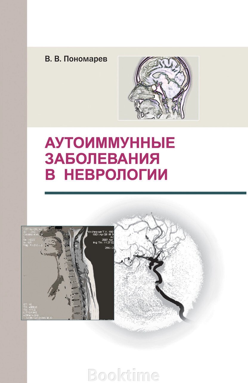 Аутоімунні захворювання у неврології від компанії Booktime - фото 1