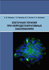 Клітинна терапія при нейродегенеративних захворюваннях