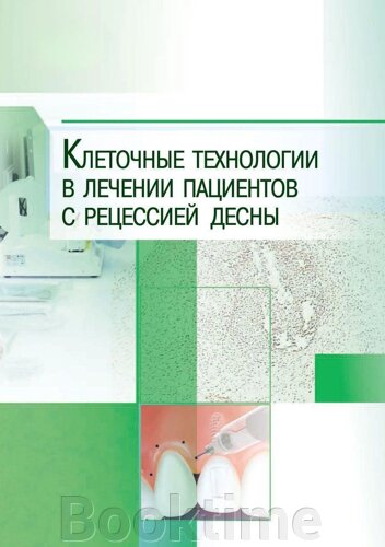 Клітинні технології в лікуванні пацієнтів з рецесією ясен