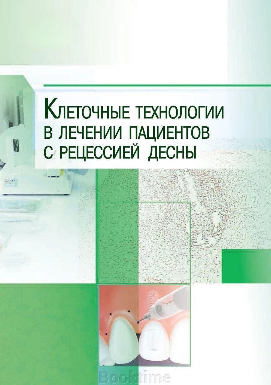 Клітинні технології в лікуванні пацієнтів з рецесією ясен від компанії Booktime - фото 1