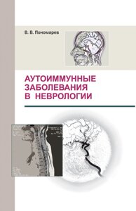 Аутоімунні захворювання у неврології