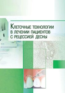 Книга: Клітинні технології в лікуванні пацієнтів з рецесією ясен