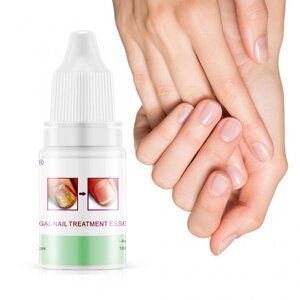 Відновлюючий крем для нігтів Omy Lady Fungal Nails Treatment, 5мл в Києві от компании Elektromax