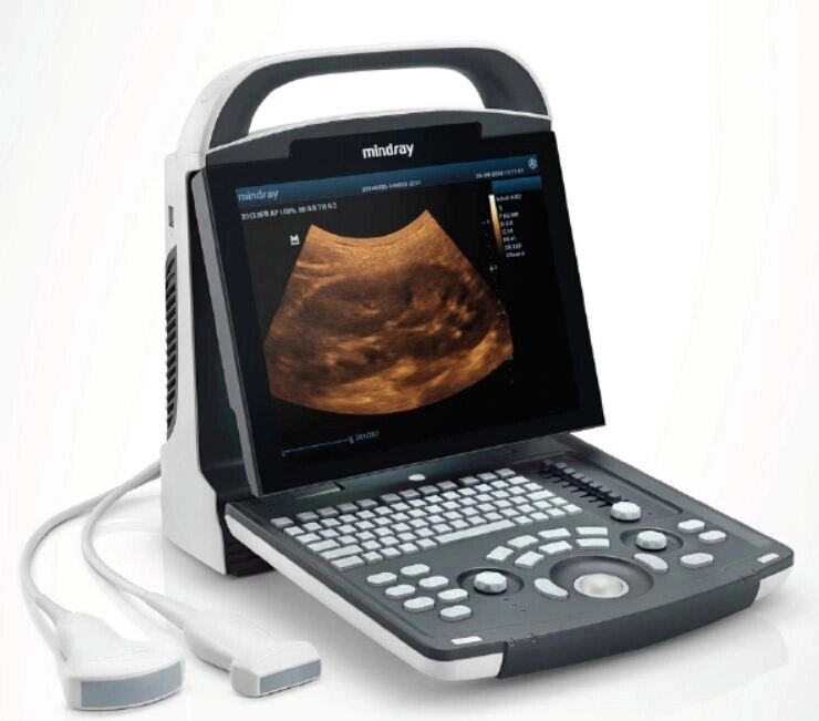 Система ультразвукова діагностична Mindray DP-10 від компанії Компанія "Алмедика" - фото 1