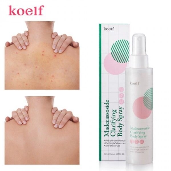 Очищающий спрей для тела c мадекассосидом Koelf Madecassoside Clarifying Body Spray 150ml від компанії ПРОФІКО - фото 1