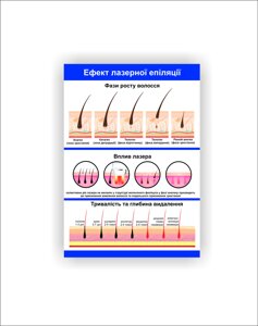 Плакат Vivay Ефект лазерної епіляції 30х40 см Білий
