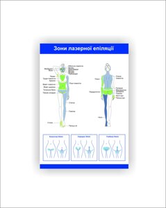 Плакат Vivay Зони лазерної епіляції 30х40 см Білий