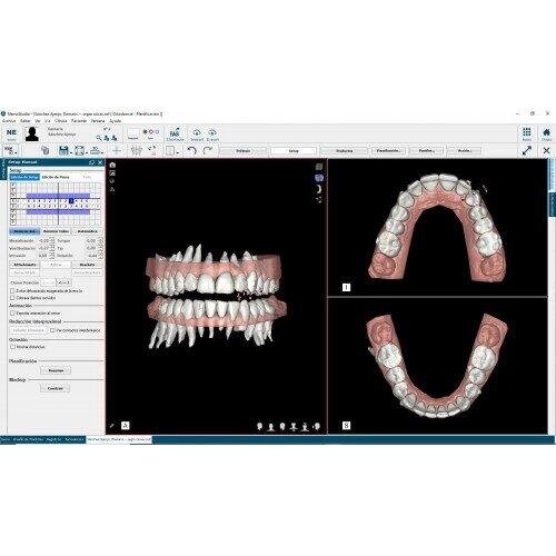 Цифрова стоматологія NemoCast від компанії Медтехніка ZENET - Товари для здоров'я, затишку та комфорта - фото 1