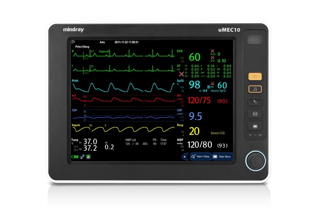 Монітор пацієнта Mindray uMEC10 від компанії Медтехніка ZENET - Товари для здоров'я, затишку та комфорта - фото 1