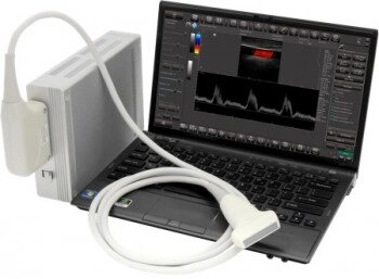 УЗД сканер SmartUs від компанії Медтехніка ZENET - Товари для здоров'я, затишку та комфорта - фото 1