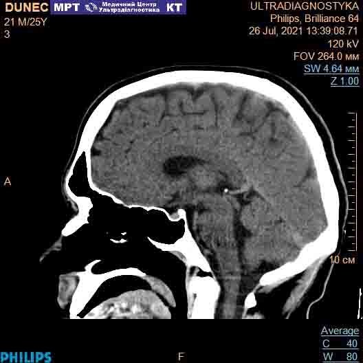 КТ головного мозку від компанії МРТ КТ Хмельницький Ультрадіагностіка - фото 1