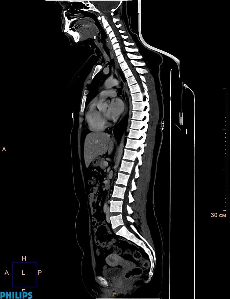 КТ хребта спини від компанії МРТ КТ Хмельницький Ультрадіагностіка - фото 1