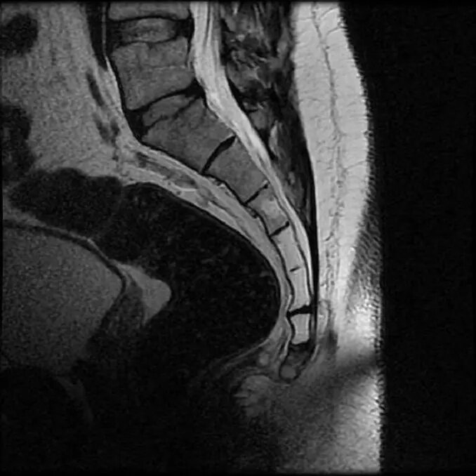 КТ крижів і куприка від компанії МРТ КТ Хмельницький Ультрадіагностіка - фото 1