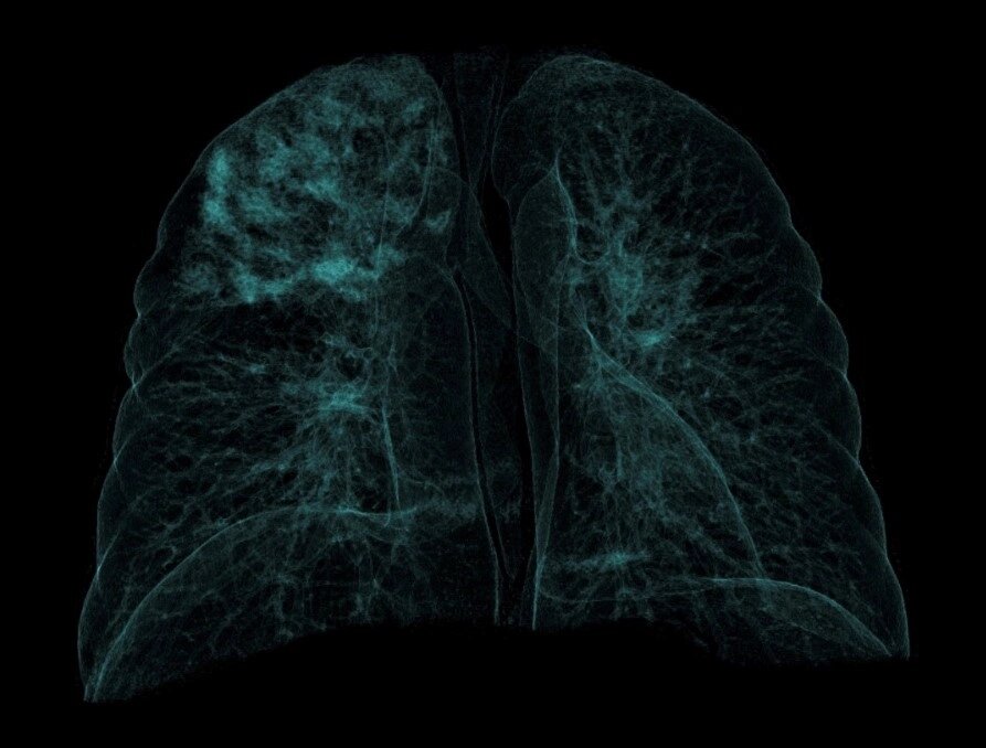 КТ легенів зробити записатися пройти Хмельницький від компанії МРТ КТ Хмельницький Ультрадіагностіка - фото 1