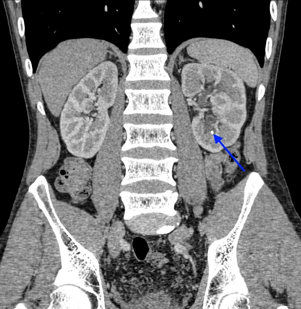 КТ нирок і надниркових залоз від компанії МРТ КТ Хмельницький Ультрадіагностіка - фото 1
