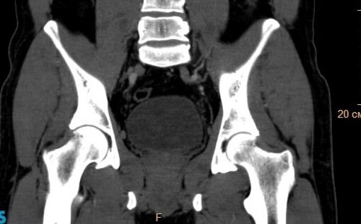 КТ органів малого таза від компанії МРТ КТ Хмельницький Ультрадіагностіка - фото 1