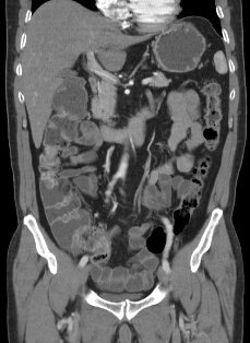 КТ печінки, селезінки, підшлункової залози, шлунка від компанії МРТ КТ Хмельницький Ультрадіагностіка - фото 1