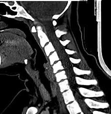 КТ шийного відділу хребта, шиї від компанії МРТ КТ Хмельницький Ультрадіагностіка - фото 1