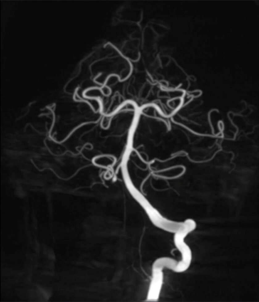 МРТ ангіографія діагностика Судін голови та шії від компанії МРТ КТ Хмельницький Ультрадіагностіка - фото 1