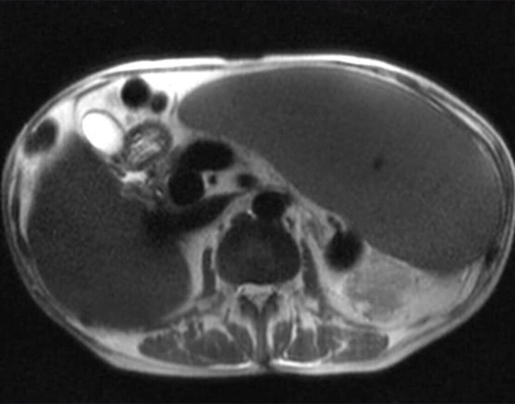 МРТ черевної порожнини та поза черевного простору від компанії МРТ КТ Хмельницький Ультрадіагностіка - фото 1