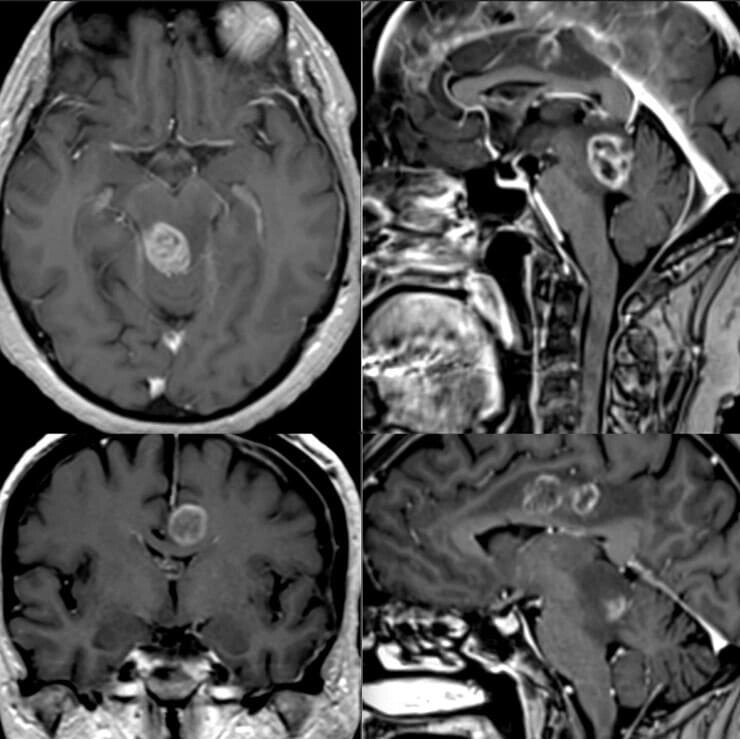 МРТ головного мозку від компанії МРТ КТ Хмельницький Ультрадіагностіка - фото 1
