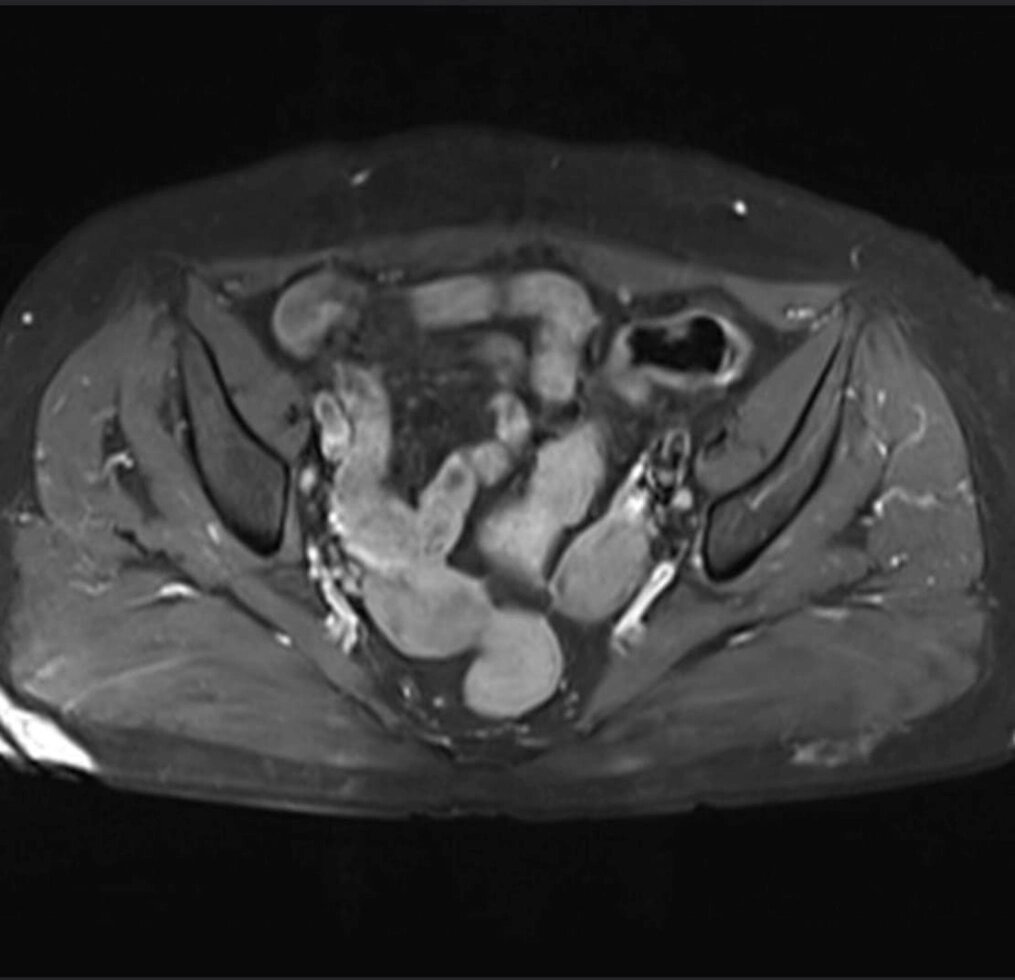 МРТ малого тазу у жінок (фаллопієві труби, матка, Шийка матки и Січових міхур) від компанії МРТ КТ Хмельницький Ультрадіагностіка - фото 1