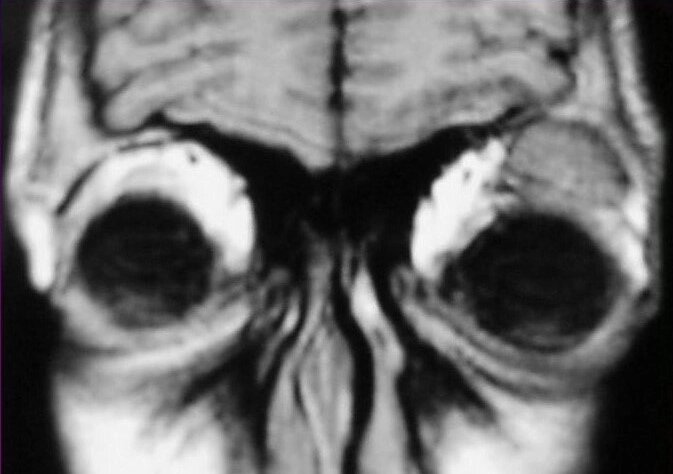 МРТ ока і очних орбіт, очей від компанії МРТ КТ Хмельницький Ультрадіагностіка - фото 1