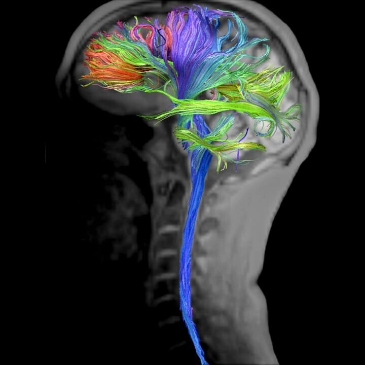МРТ трактографія головного мозку голови від компанії МРТ КТ Хмельницький Ультрадіагностіка - фото 1