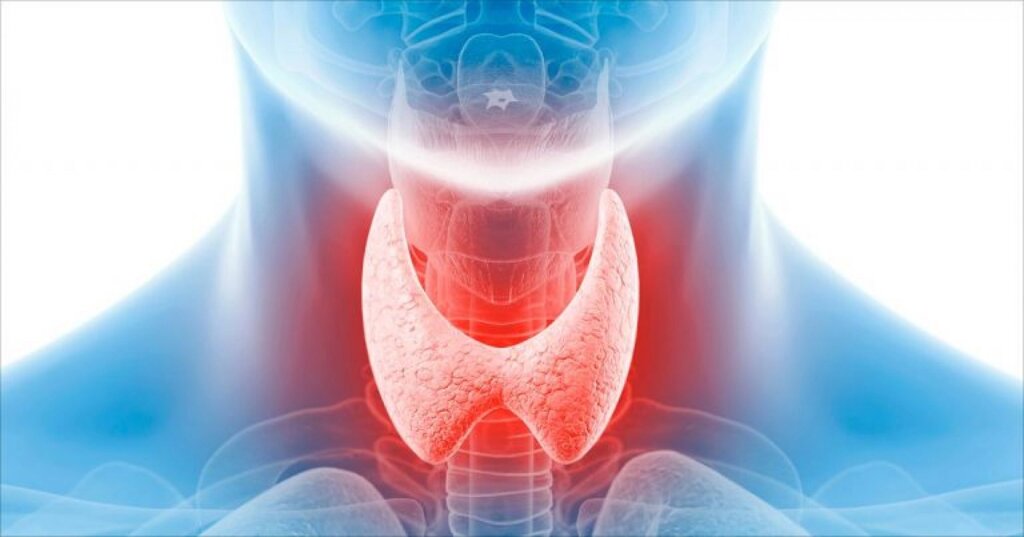 УЗД щитовидної залози, щитовидної залози від компанії МРТ КТ Хмельницький Ультрадіагностіка - фото 1