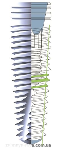 Імплантат Bio3 Advanced Diametr 5.0 - фото