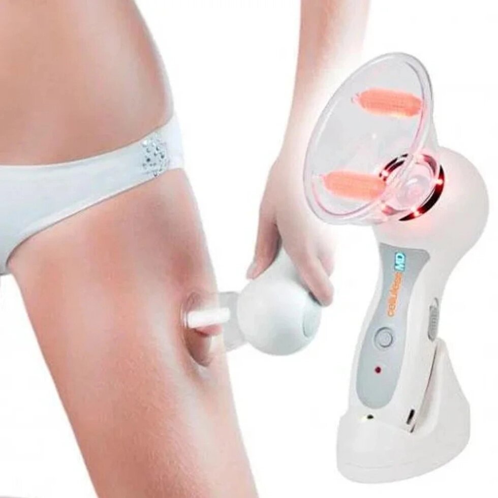 Масажер для тіла MD CELLULESS MASSAGER від компанії da1 - фото 1