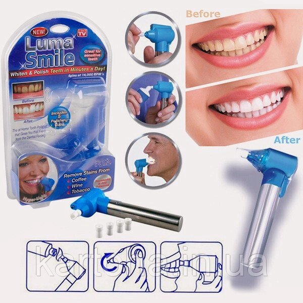Набір для відбілювання зубів Luma Smile від компанії Інтернет-магазин "Tovar-plus. Com. Ua" - фото 1